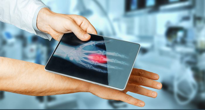 Medical devices innovative device innovation medicare used question real 2020 research obamacare most legacymedsearch